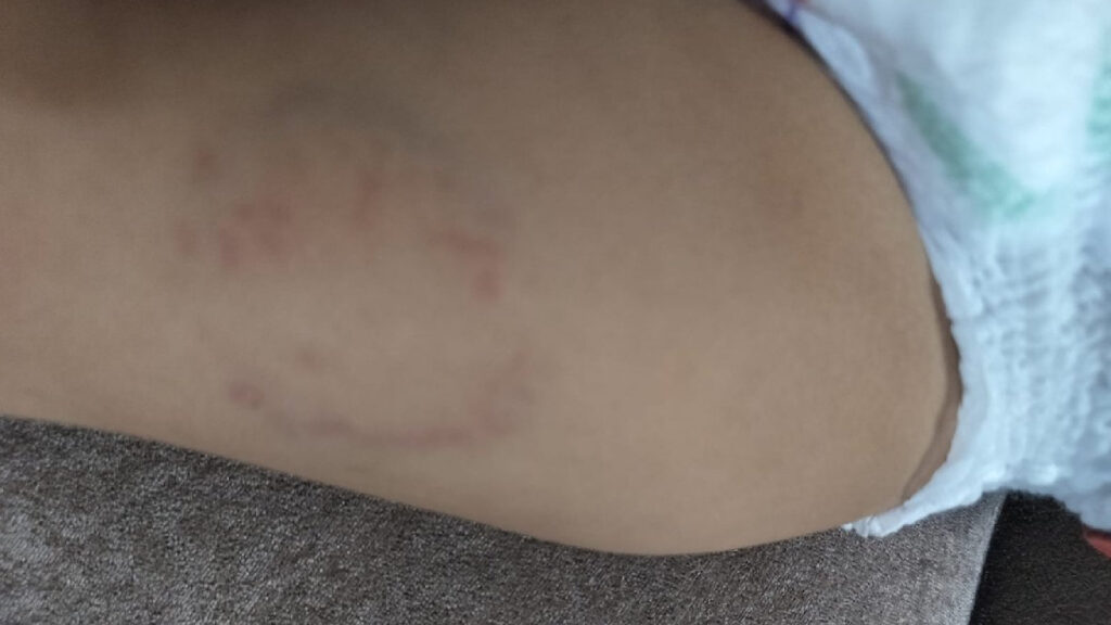 Noida Daycare Worker Arrested for Allegedly Biting and Assaulting a 15-Month-Old Baby