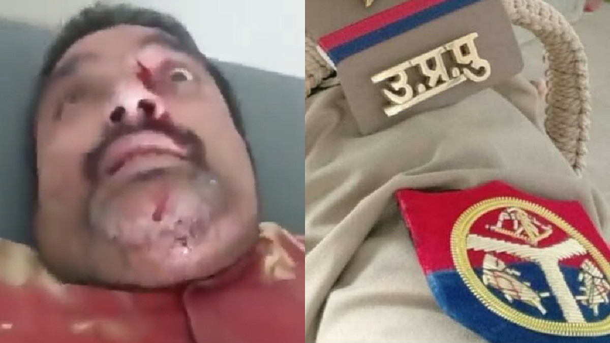 Varanasi Police Brutality: Advocate Severely Injured After Being Beaten in a Public Square