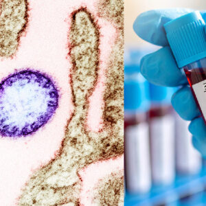 West Bengal Reports Two Possible Nipah Virus Cases, Centre Steps Up Alert