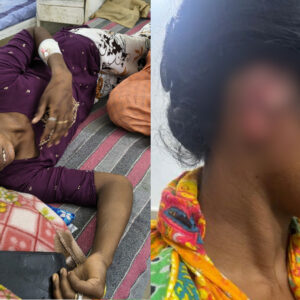 देवरानी-जेठानी के झगड़े में कान काटने का आरोप