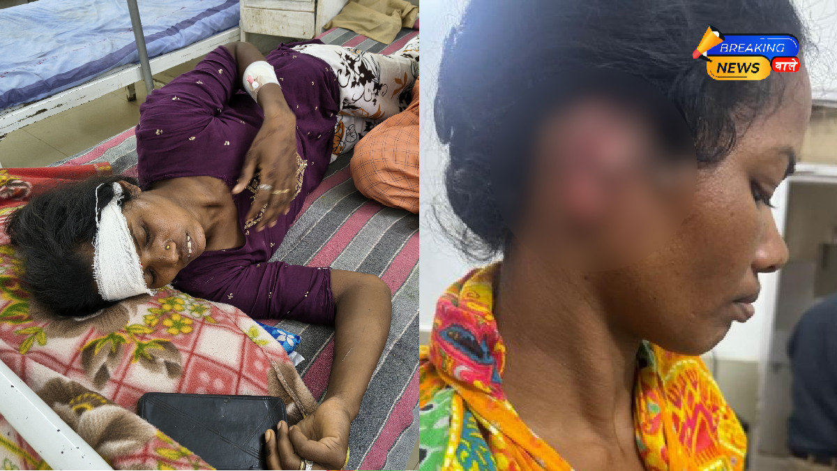 देवरानी-जेठानी के झगड़े में कान काटने का आरोप